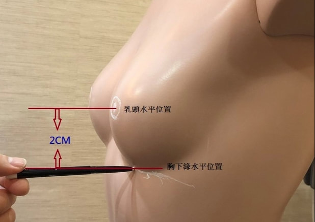 圖片正常沒有下垂的乳房從側面看乳頭水平位置應該比胸下緣水平位置高至少2公分以上。