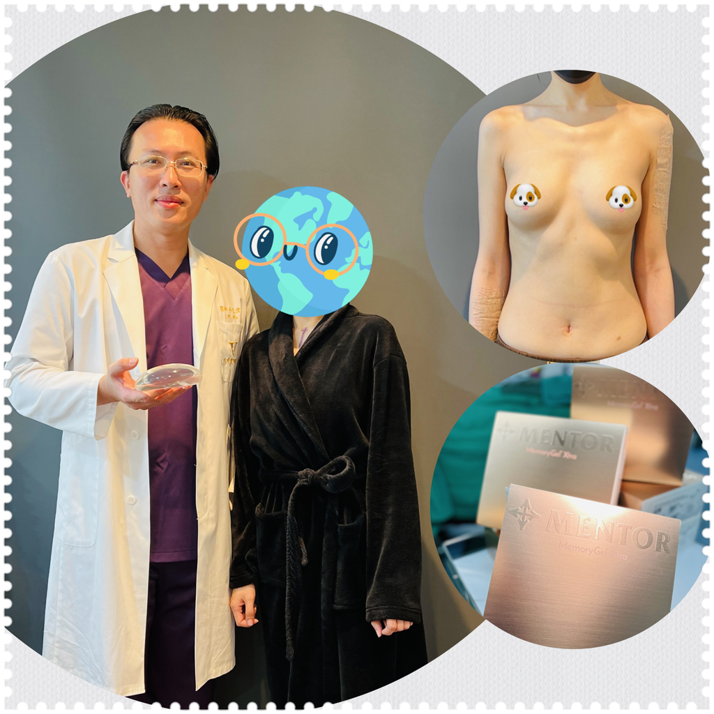 光第一例曼陀光滑面女王波隆乳