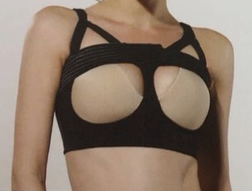 圖片二次隆乳一般則需穿著上胸帶與隆乳定位衣〔吳至偉醫師〕