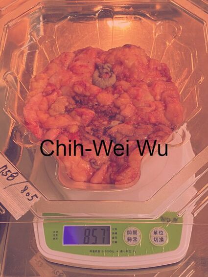 縮胸手術單側切除超過800克的乳房組織