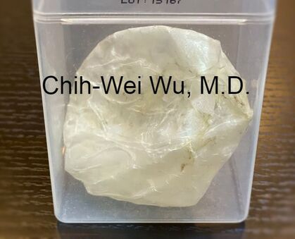 莢膜是包在假體外面的一層膜，在好的狀況下，這層膜很薄且有點透光。